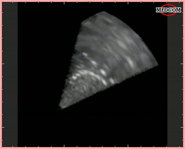 Adaptive 16x16 thumbnail