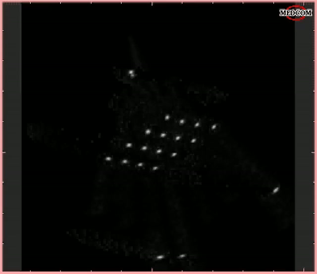 Adaptive 32x32 thumbnail