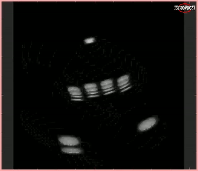 Conventional 32x32 thumbnail